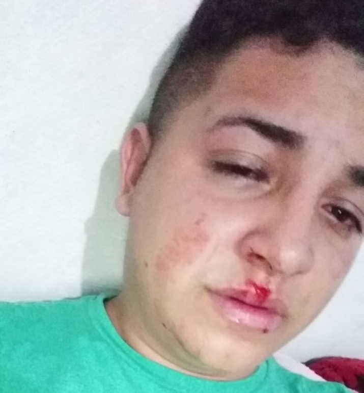 Leonardo Gama após ser agredido perto de casa em Jaibara dos Nogueiras