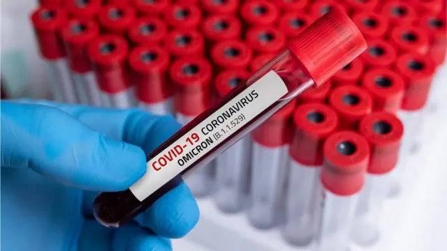 5 novos casos de COVID-19 são registrados em Itapecuru Mirim, alerta prefeitura